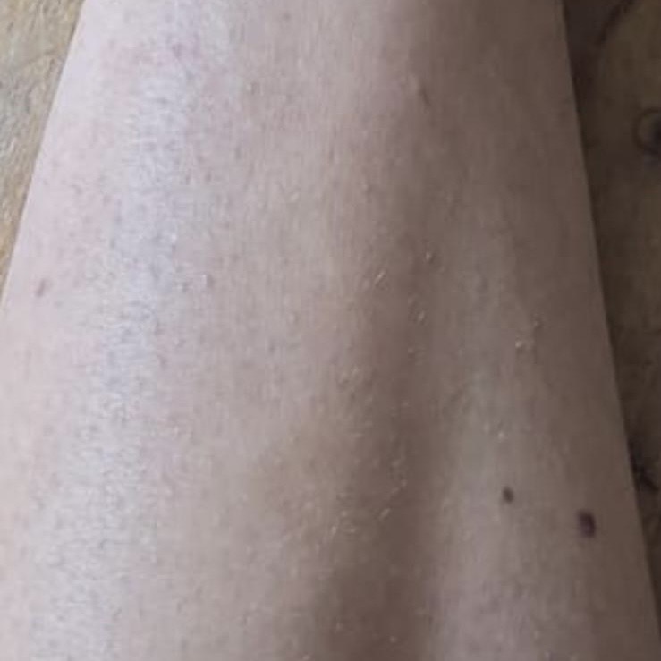 Instagram Bild von esovita